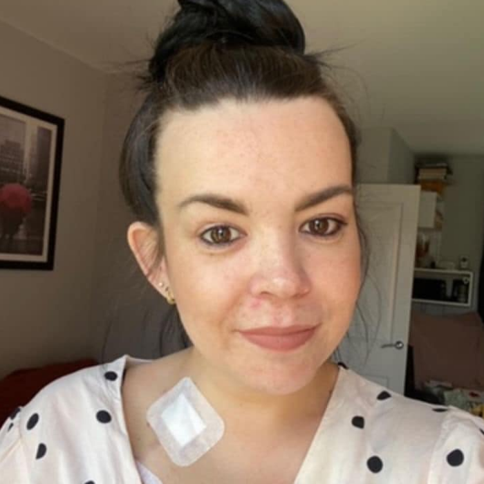 Read more about the article Sarah’s Story: “I Was Told My Kidneys Were Failing at 2% — But This Isn’t the End of My Story”